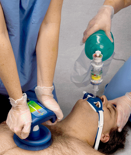 Image: Placement of the ResQPump and the ResQPOD during CPR (photo courtesy of Advanced Circulatory Systems).